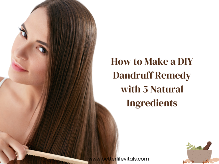 Home Dandruff remedy